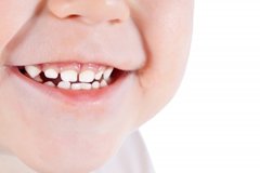 Toddler Tooth Development Chart