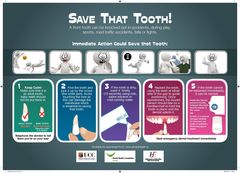 Publication cover - SaveThatTooth_New 30.07.2014