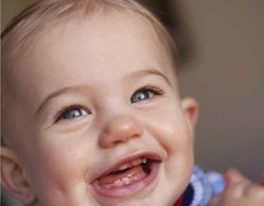 Oral health Baby Photo